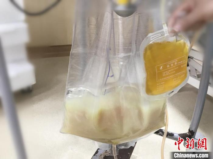 　　正常的血浆清澈透亮，是淡黄色透明状的；而从阿宁身体里过滤出的血浆，白花花一片，已经是乳白色的油脂了。 天台县人民医院供图