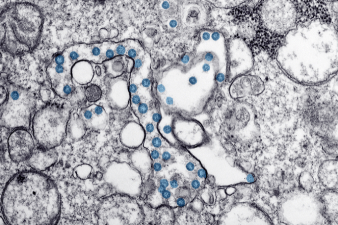 　　△血氧水平低通常会引起明显的症状，但一些新冠肺炎患者正在经历医生所说的“快乐缺氧”。图据美国疾控中心