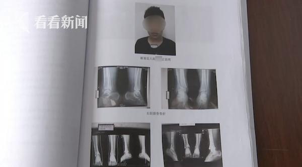 初二男生被老师“喊家长”后跳楼致残 状告校方！法院：驳回