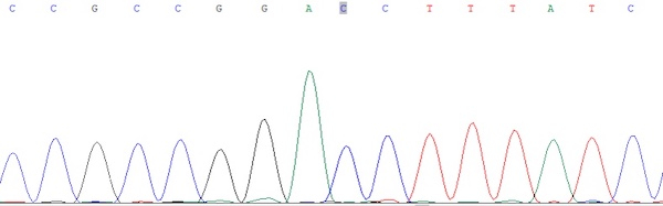 图说：FUT1测序结果：基因测序显示有基因突变