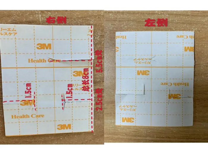 外科胶带怎么撕PICC这样固定,太安全了!_新闻资讯_第8张_活检穿刺产品网 外科胶带怎么撕PICC这样固定,太安全了!_https://www.jmylbn.com_新闻资讯_第8张