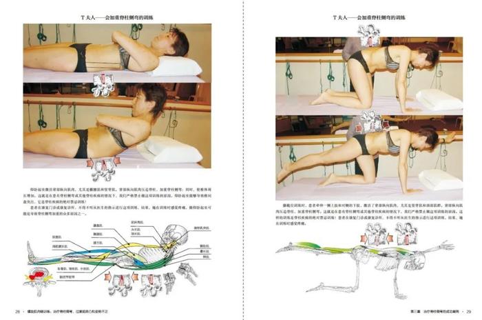 好书推荐 | 令人尖叫的技术---螺旋肌肉链训练·第3册震撼上市---治疗脊柱侧弯、过度前前后凸和姿势不正