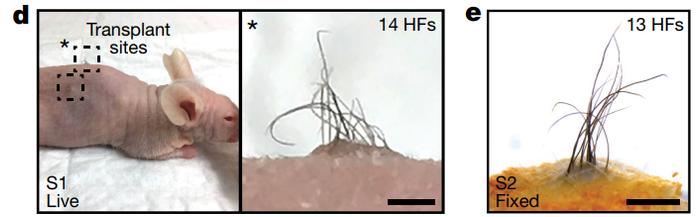《自然》重磅：治疗头秃迎来重大突破！科学家首次培养出最接近真实形态和功能的皮肤类器官，移植后生发率达到55%丨科学大发现