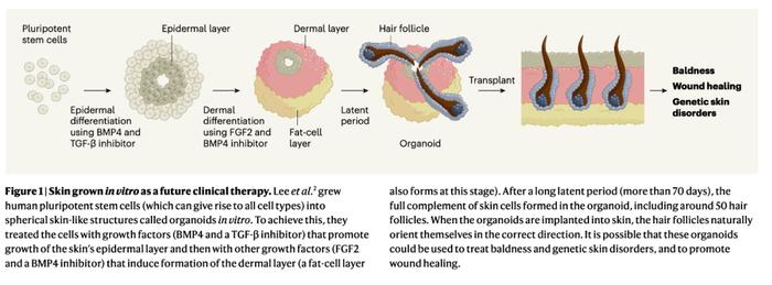 《自然》重磅：治疗头秃迎来重大突破！科学家首次培养出最接近真实形态和功能的皮肤类器官，移植后生发率达到55%丨科学大发现
