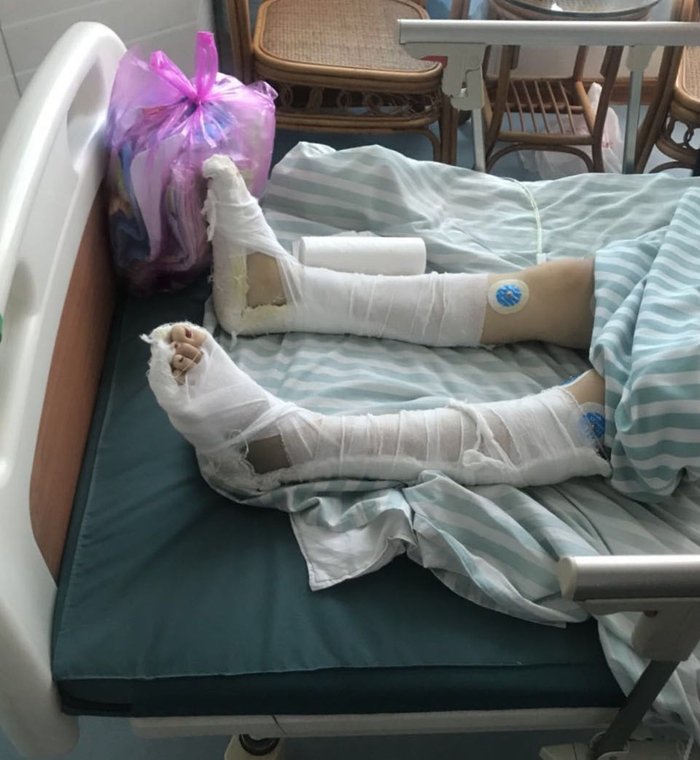 当事人刘女士被打后的情况 来源：知情人士提供