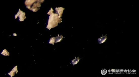 ▲显微镜下的尘螨