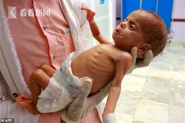 也门援助资金耗尽再临饥荒 数百万家庭很快"撑不下去"