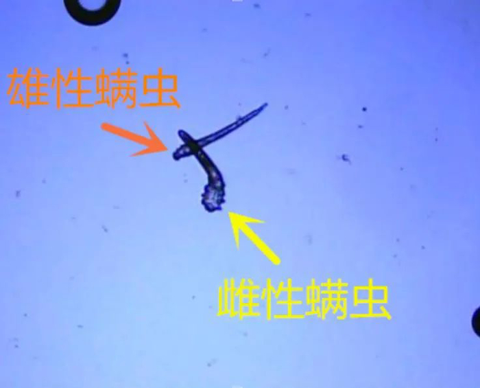 显微镜下观察到的蠕形螨/图片来源：医院提供