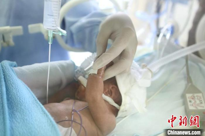 经过积极治疗，出生体重为1000g—1500g的早产儿存活率已接近发达国家水平。儿科医院供图