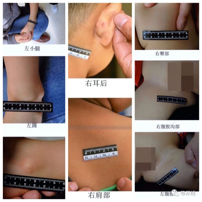 2018年10月，部分儿童鉴定时留下的照片。&nbsp;受访者供图