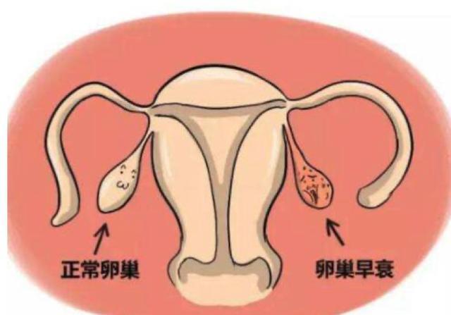 100个年轻女性就有1个会中招，卵巢早衰及保养提前了解一下