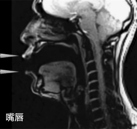 科学有意思 | 声音是如何从喉咙发出的？在核磁共振下唱歌试试