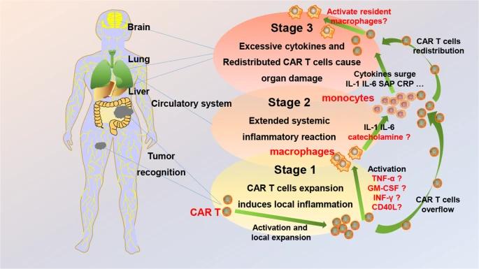 B细胞非霍奇金淋巴瘤与其他血液瘤CAR-T治疗管理大不同，CRS分级要看这两个指标