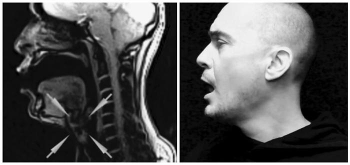 科学有意思 | 声音是如何从喉咙发出的？在核磁共振下唱歌试试
