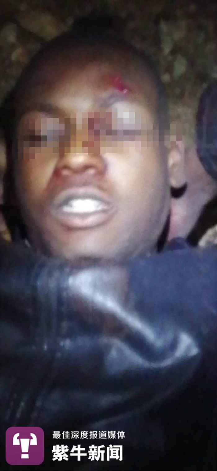 这名受伤劫匪的腰部和腿部中了枪，前额有撞伤