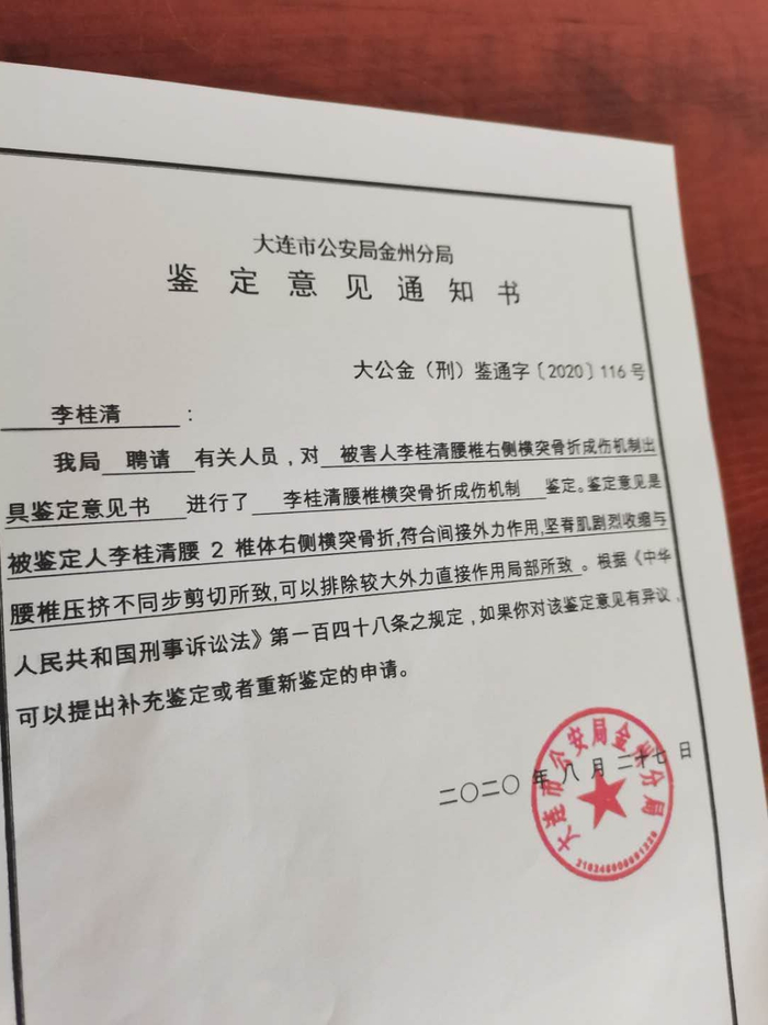  成伤机制鉴定称是间接外力致骨折。