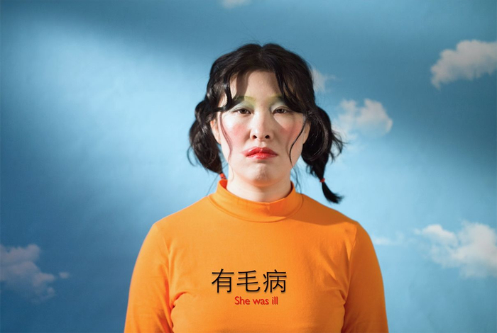 李远明，《有毛病》，2019年。图片由艺术家提供