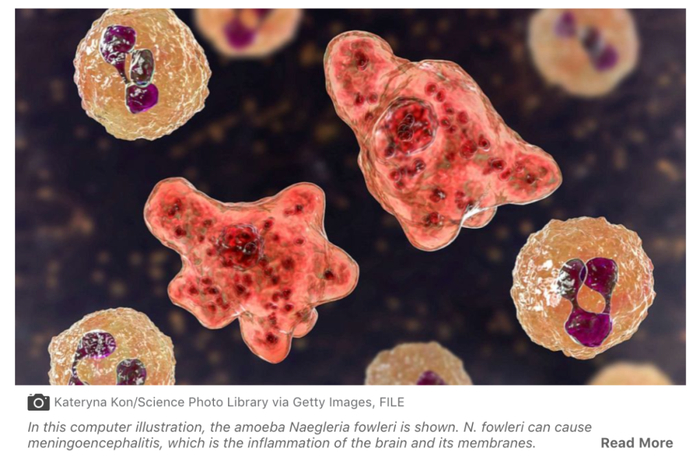 在计算机图中显示的福氏耐格里变形虫。/&nbsp;美国广播公司网站截图