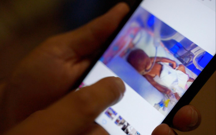 许俊的手机上存满了小宝在不同时期接受治疗的照片。新京报记者 孙钊 摄
