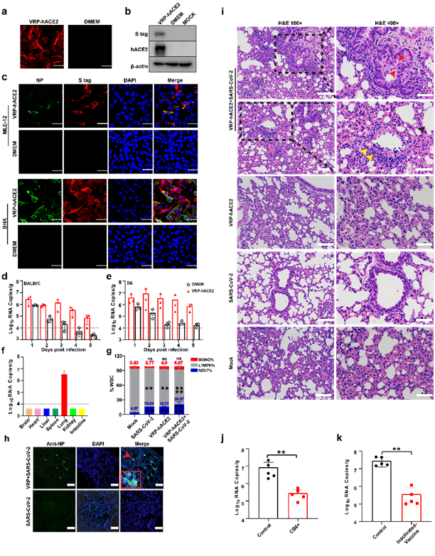 一种新型冠状病毒肺炎小鼠动物模型的建立。（a-b）VEEV-VRP-hACE2表达验证（a）IFA；（b）Western blotting；（c）MLE-12和BHK-21感染VEEV-VRP-hACE2后可转变为SARS-CoV-2易感细胞；（d-e）SARS-CoV-2可在转导hACE2的（d）BALB/c以及（e）C57BL/6肺部高水平复制；（f）转导hACE2的BALB/c小鼠感染SARS-CoV-2后不同脏器病毒载量检测；（g）转导hACE2的BALB/c小鼠感染SARS-CoV-2后血相变化；（h）转导hACE2的BALB/c小鼠感染SARS-CoV-2后肺部病毒免疫荧光检测；（i）转导hACE2的BALB/c小鼠感染SARS-CoV-2后肺部病理特征；（j）注射中和抗体或（k）免疫灭活疫苗后的BALB/c转导hACE2，SARS-CoV-2攻毒后的肺部病毒载量。来源：武汉病毒所