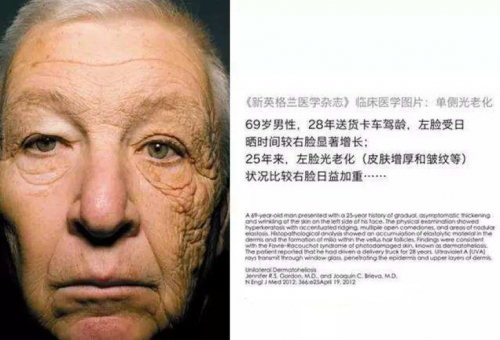 别让肌肤未老先衰，赛林菲尼助你对抗皮肤光老化