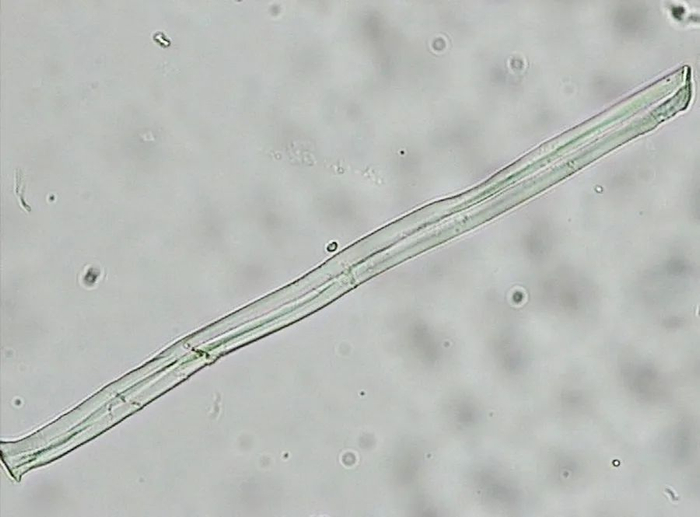 显微镜下的罗布麻纤维（图源自网络）