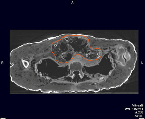 图为使用CT技术看到的木乃伊化朱鹭鸟。