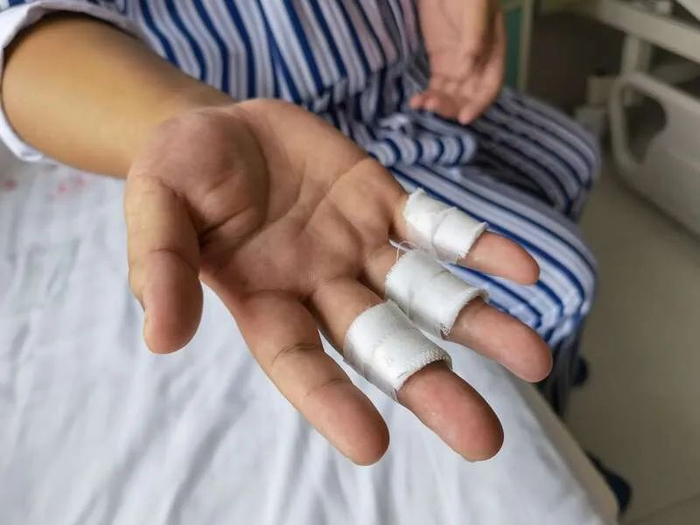 杨旭恒在洪灾中擦伤的手。赵京亚 摄