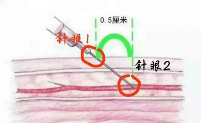 采血管抽血顺序到底哪个先?一文搞定静脉采血9大问题