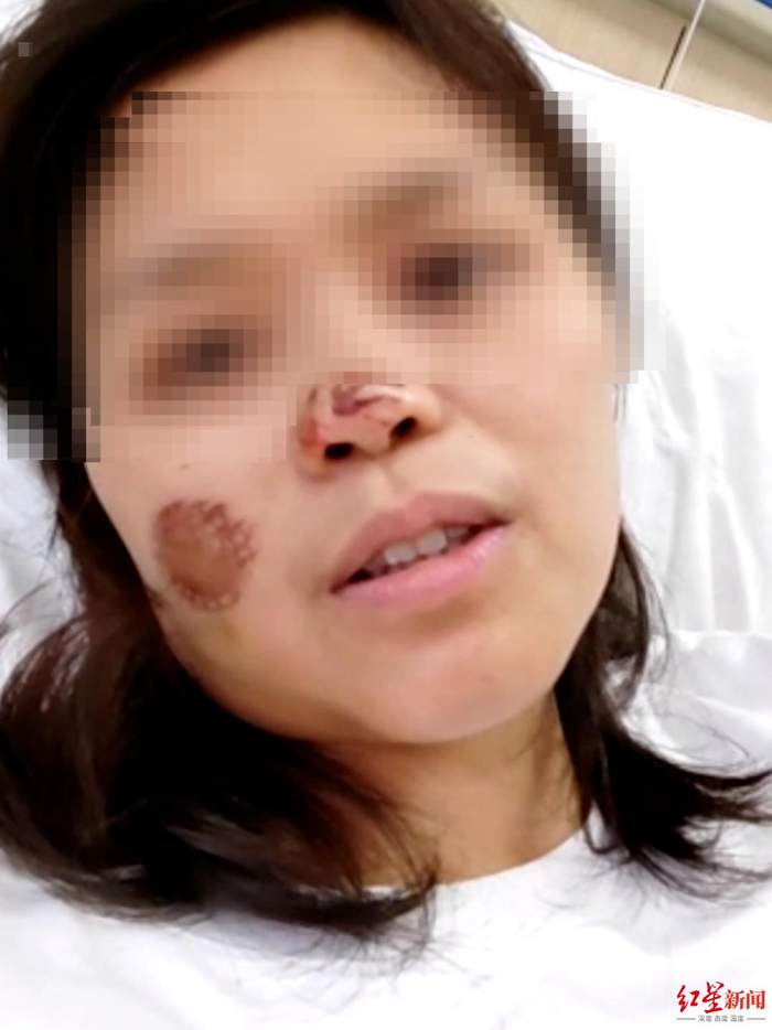 手动病床怎么装视频食堂厨师连捅女经理17刀:疑因将被辞退起杀机,涉嫌故意杀人,警方已立案_新闻资讯_第1张_活检穿刺产品网 手动病床怎么装视频食堂厨师连捅女经理17刀:疑因将被辞退起杀机,涉嫌故意杀人,警方已立案_https://www.jmylbn.com_新闻资讯_第1张