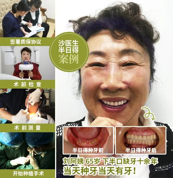 ▲沙医生口腔种植科主任为刘阿姨