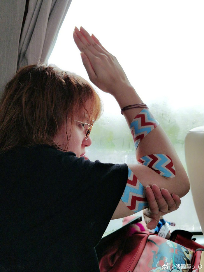 傅园慧手臂上的肌肉贴。