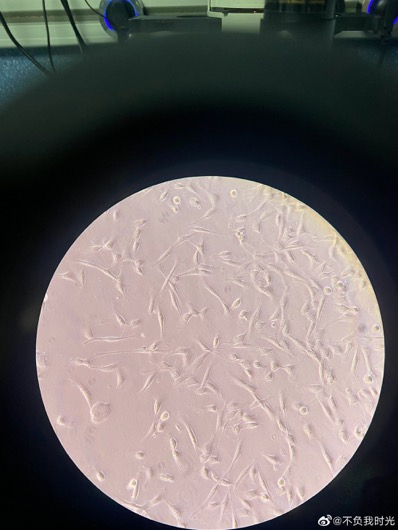 徐伟培养的干细胞。受访者供图