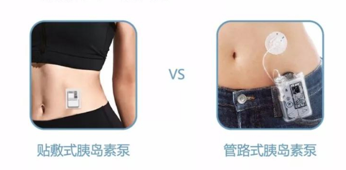 微泰胰岛素泵怎么样微泰医疗在港招股：手握3款上市产品，年亏1.2亿_https://www.jmylbn.com_新闻资讯_第8张