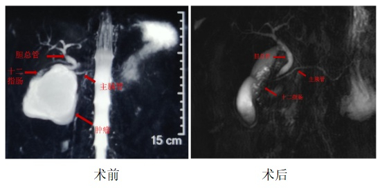术前和手术后对比。哈医大一院 供图