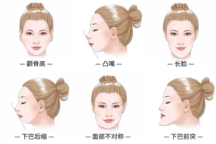 ▲牙颌畸形引起的颌面部问题