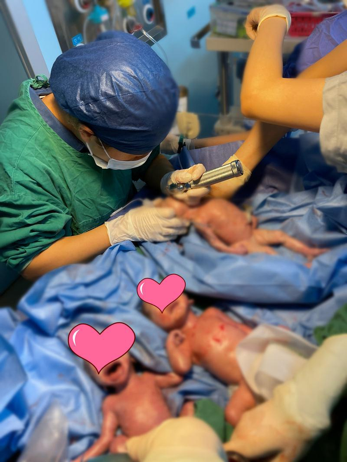 ▲刚降生人间的“三个小宝贝”。