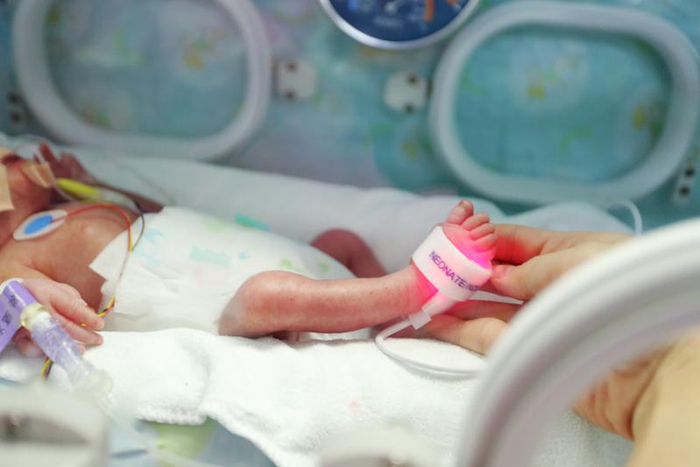 ▲早产宝宝小小的脚和成人的大手形成鲜明对比。