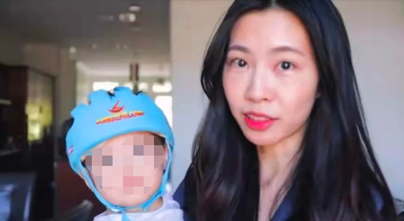 ▲博主yaya和正在进行头型矫正治疗的女儿的合照