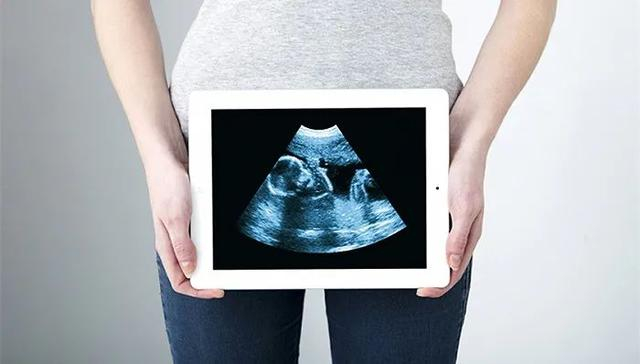 视觉中国图 图文无关 