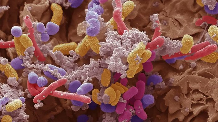 细菌性皮肤感染电镜扫描图，图片来源：Origimm官网