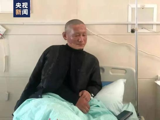 △ 被烧伤的姚森林