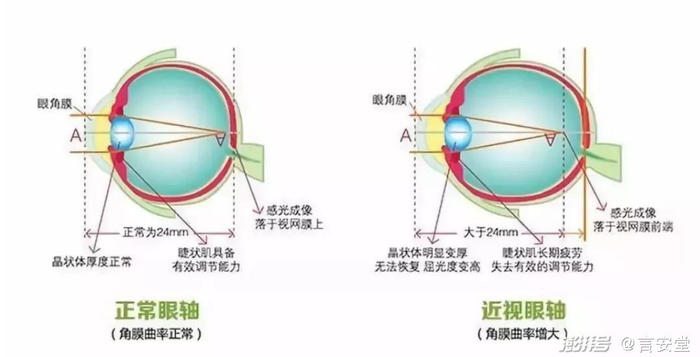                                      （图源网络：侵删）