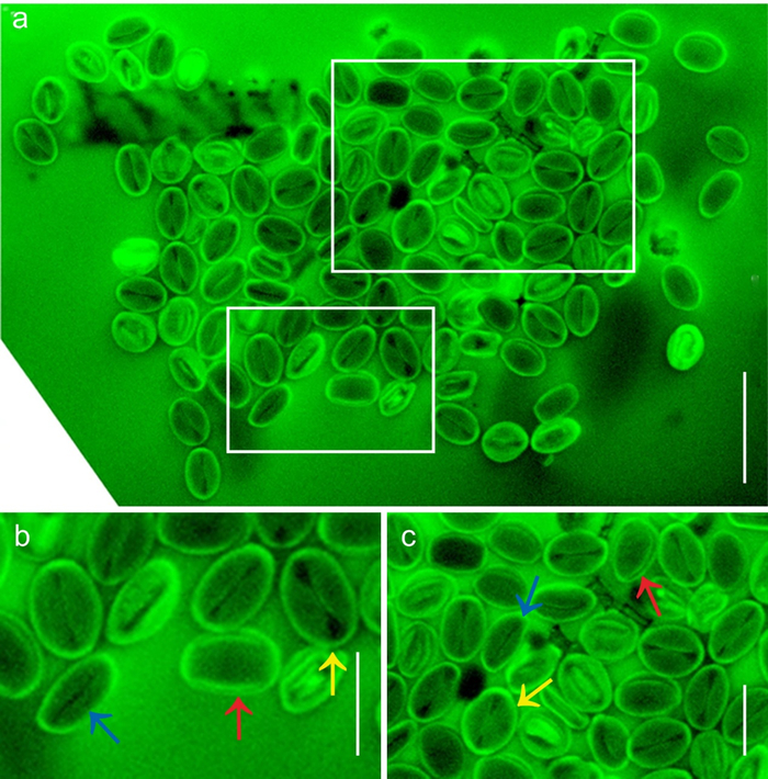 花粉簇，箭头所示花粉不属于三沟花粉。