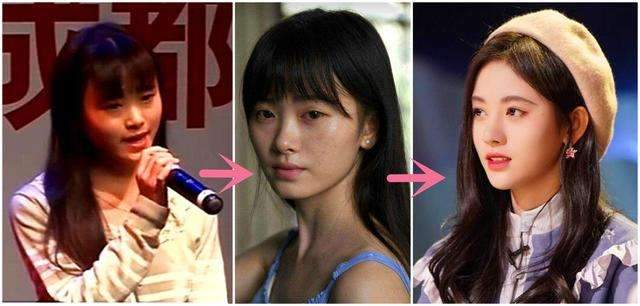 因整容的女明星：有人自毁前途，有人甚至身亡