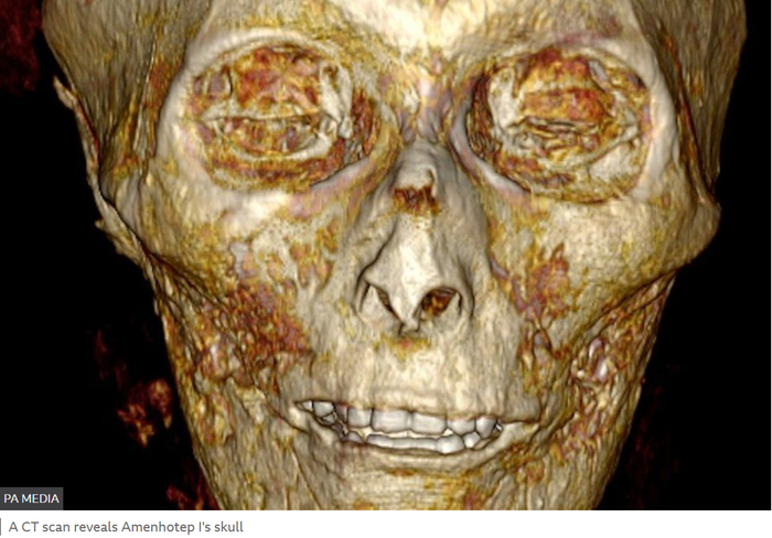 CT扫描显示阿蒙霍特普一世的头骨。BBC报道截图