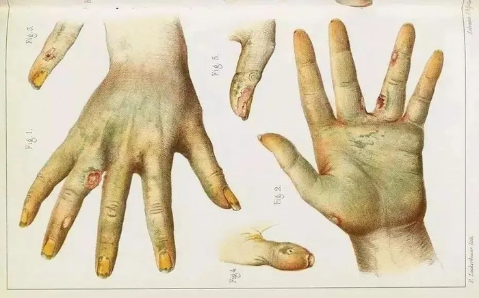 图源见参考资料