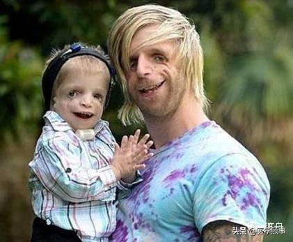 纤维肌痛的疼痛睡眠不好晨僵喝舒筋止痛方剂效果怎么样?