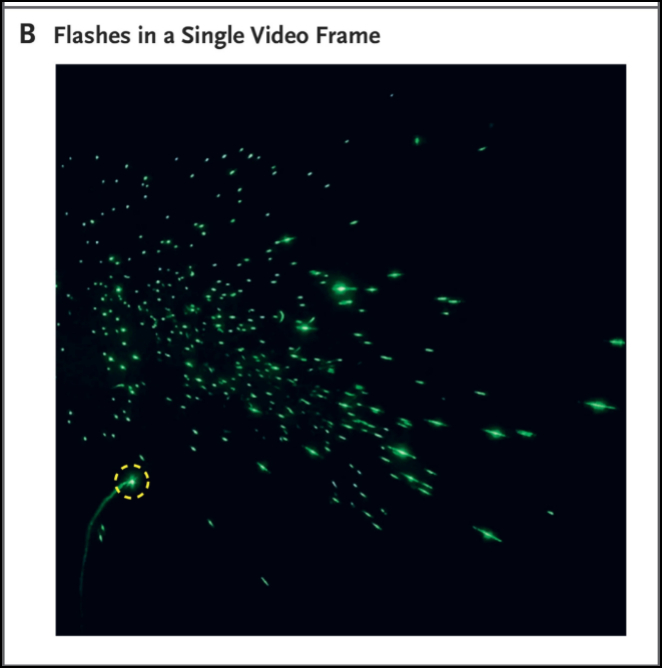  激光显示出一个人说“Stay healthy”时喷出的飞沫