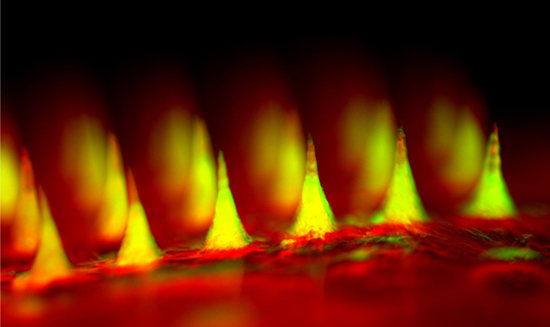     “智能胰岛素贴片”微针阵列局部特写，曾入选《科学》杂志年度十大图片。受访者供图